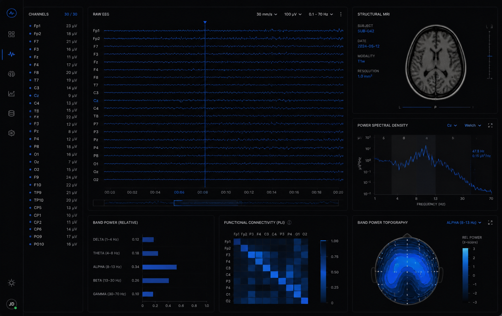 NeuroSignal interface
